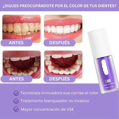 2X1 Blanqueador SmileKit Dental™2024)